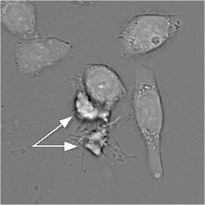 A Reverse-Osmosis Model of Apoptotic Shrinkage